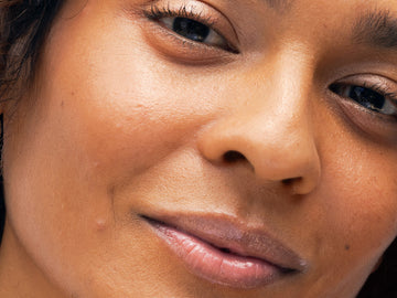 Here's What Collagen Deficiencies Look Like — And How To Fix Low Levels