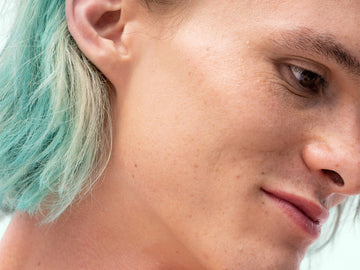 What Is Sallow Skin?